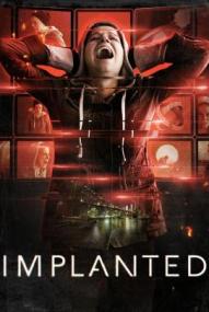 Implanted ([xfvalue_year limit=